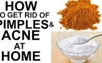 Natural Home Remedies For Acne