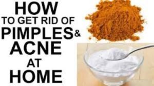 Natural Home Remedies For Acne