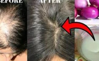 Onion Juice for Hair Growth