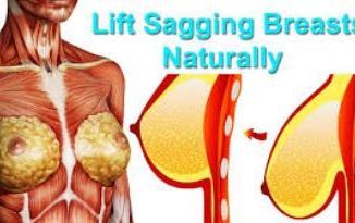Saggy Breasts