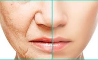 skin tightening